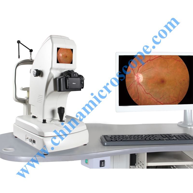 MIC-AERA fundus camera photography, photographed by the factory on white